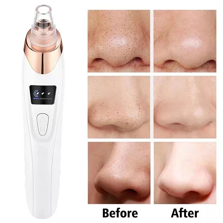 Upgraded Blackhead Remover Vacuum – Electric Pore Cleaner with 5 Probes