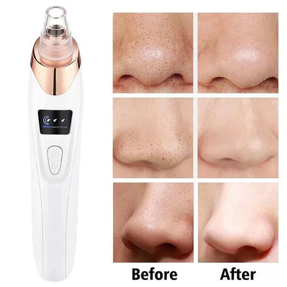 Upgraded Blackhead Remover Vacuum – Electric Pore Cleaner with 5 Probes
